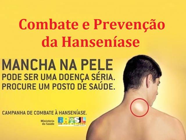 =Prevenção da Hanseníase