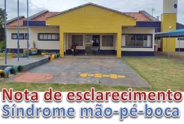 =NOTA DE ESCLARECIMENTO: SÍNDROME MÃO-PÉ-BOCA